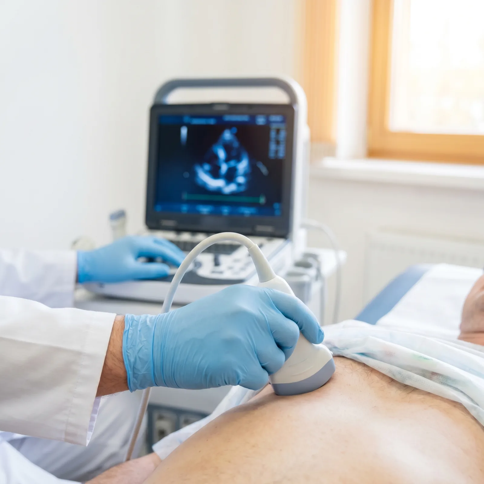 Echocardiography